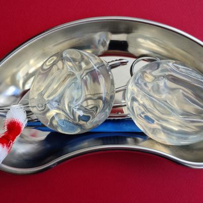 A pair of silicone breast implants on steel surgical tray as a concept of removal.