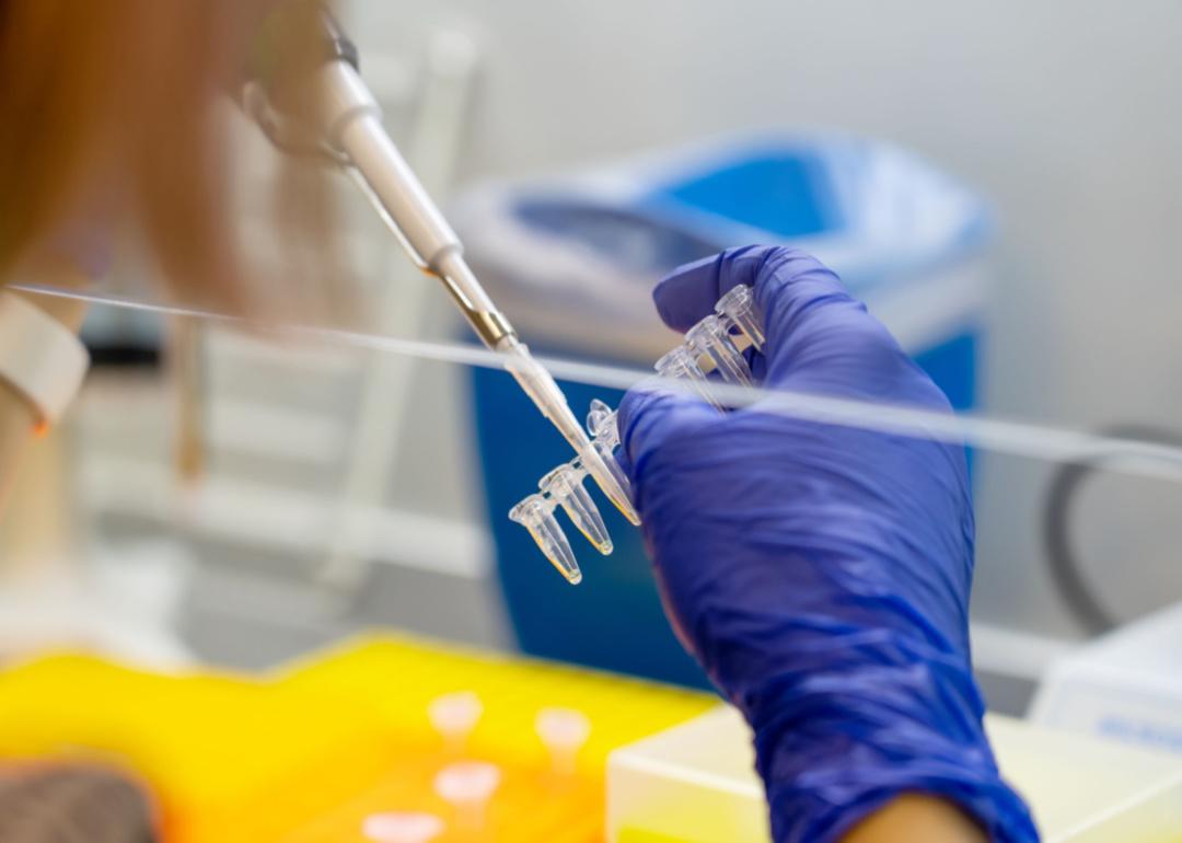 A worker's hand uses a pipette to test sampoles in a lab