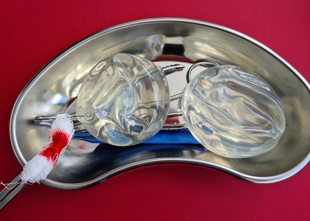 A pair of silicone breast implants on steel surgical tray as a concept of removal.