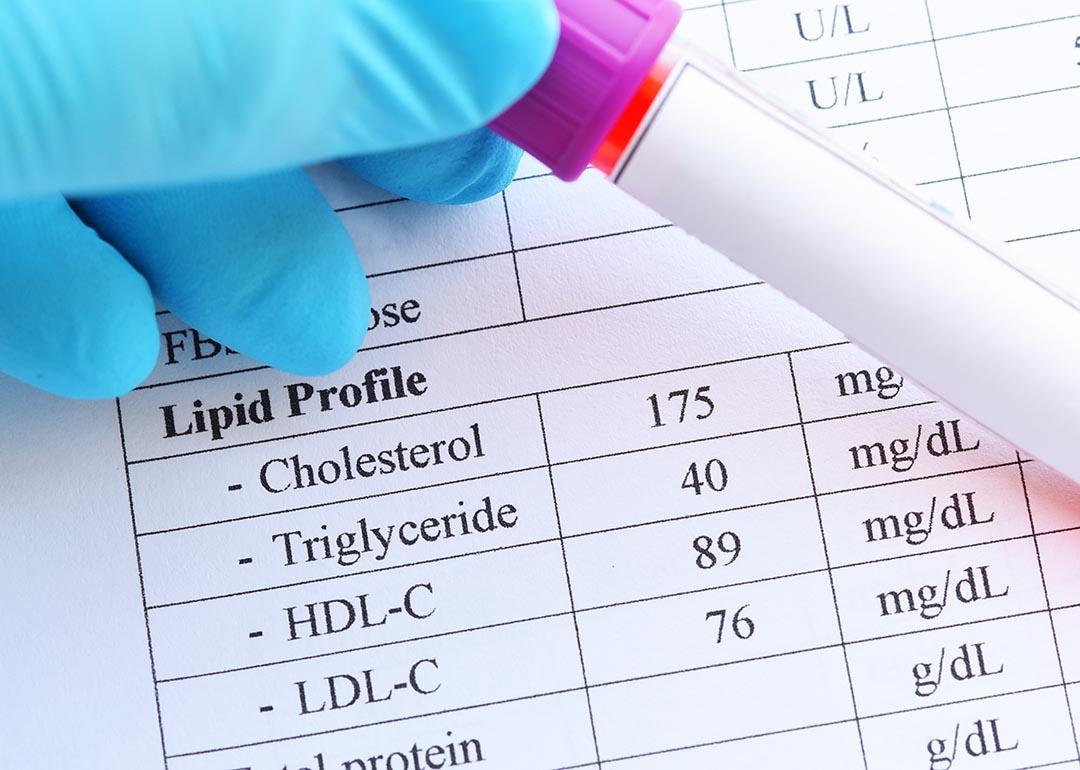 A blood sample in a test tube tube held in front of a printout of lipid profile test results. 