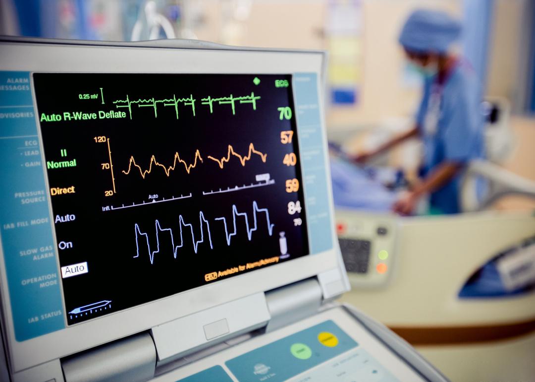 View of EKG machine with person working in background