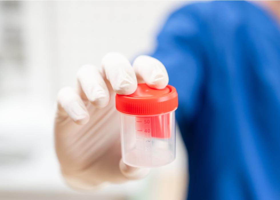 Doctor in blue uniform and medical gloves holding a container for urinalysis.