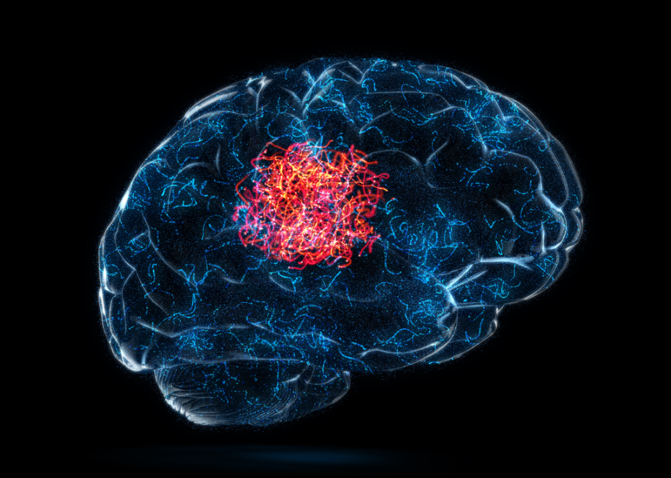 An digital scan of a brain with one area highlighted in red. 