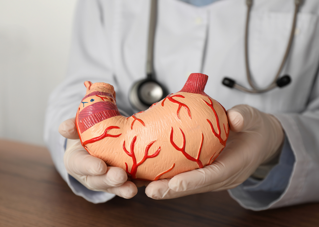 A gastroenterologist with a human stomach model.