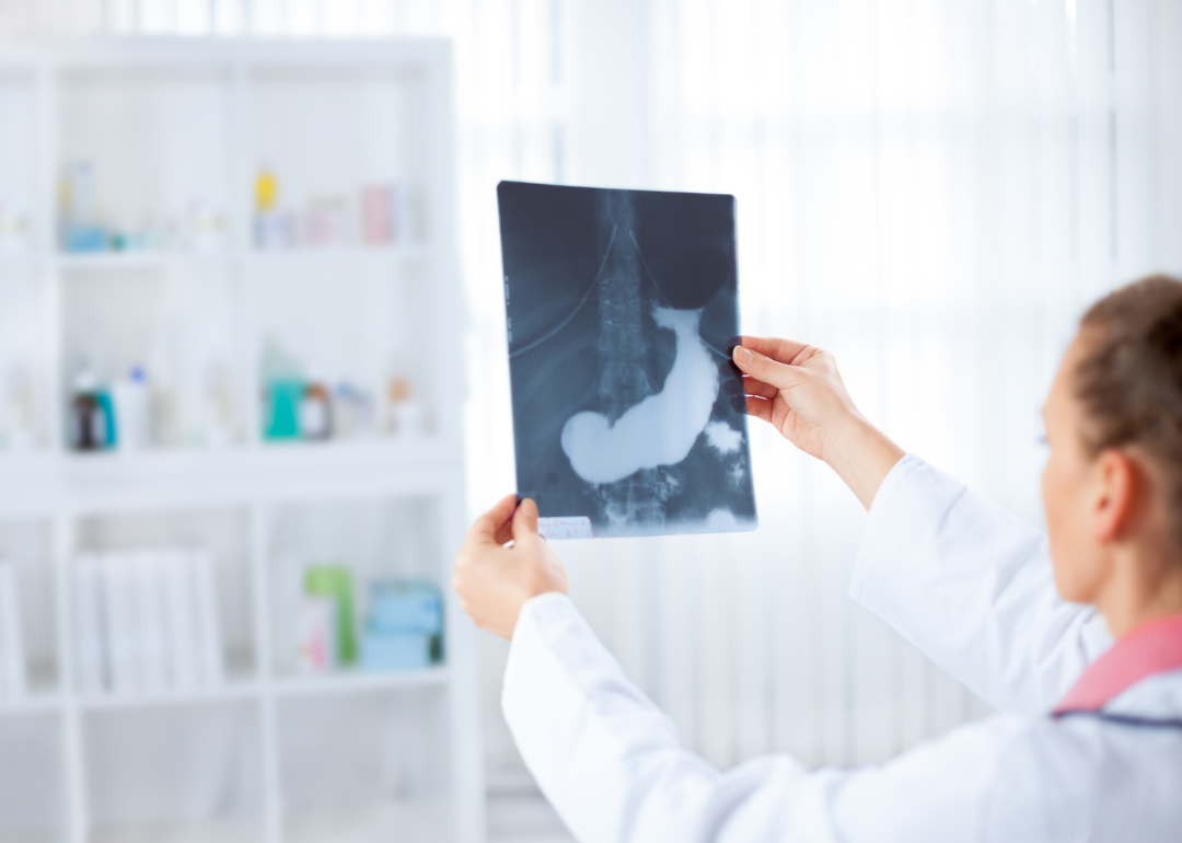 A doctor holding an x-ray of a pancreas.
